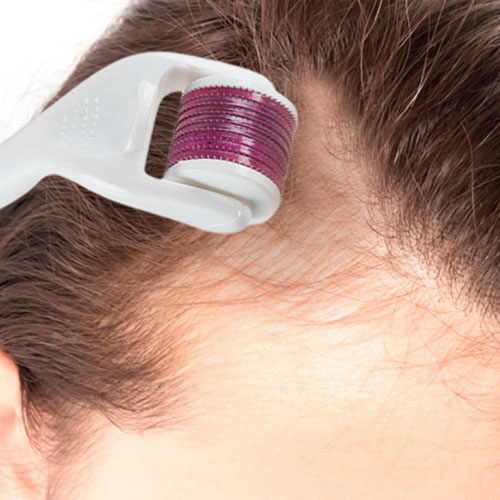 dermatologista-em-juiz-de-fora-procedimento-Microagulhamento-aberto