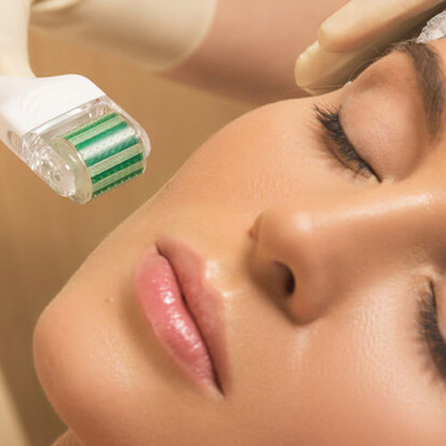 dermatologista-em-juiz-de-fora-procedimento-Microagulhamento-derme-aberto