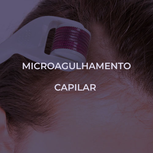 dermatologista-em-juiz-de-fora-procedimento-Microagulhamento-fechado1
