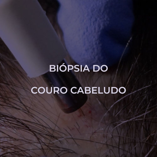 dermatologista-em-juiz-de-fora-procedimento-biopsia-fechado1