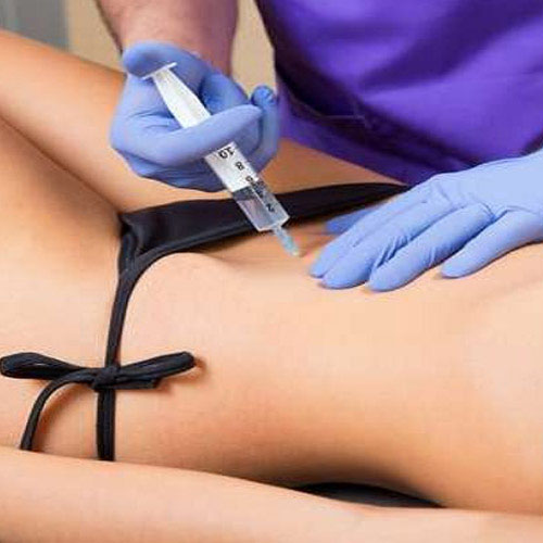 dermatologista-em-juiz-de-fora-procedimento-lipo-enzimatica-aberto