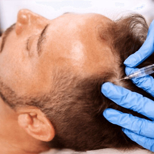 dermatologista-em-juiz-de-fora-procedimento-mesoterapia-aberto