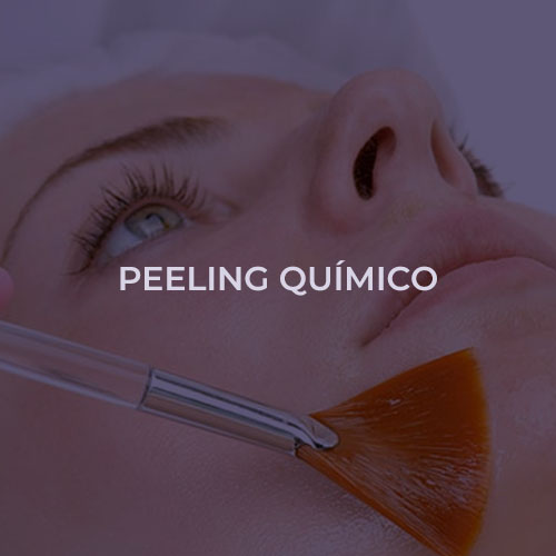 dermatologista-em-juiz-de-fora-procedimento-peeling-quimico-fechado1