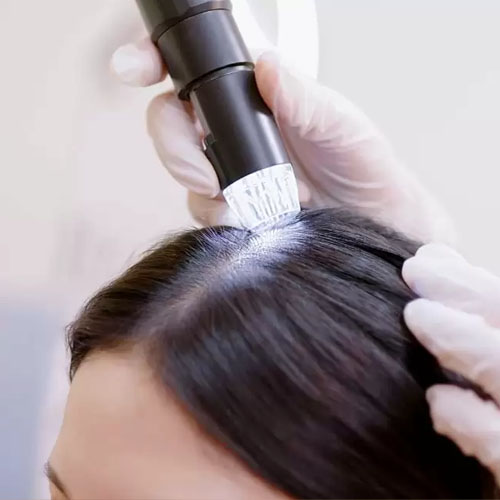 dermatologista-em-juiz-de-fora-procedimento-tricologia-aberto