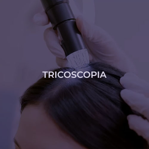dermatologista-em-juiz-de-fora-procedimento-tricologia-fechado1