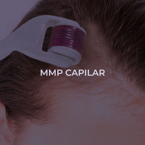dermatologista-em-juiz-de-fora-procedimento-mmp-capilar